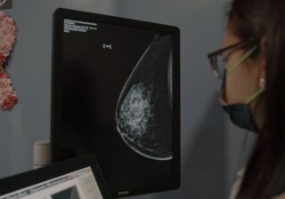 La mamografía y el ultrasonido: herramientas principales para el diagnóstico precoz en el Día Mundial contra el cáncer de ma