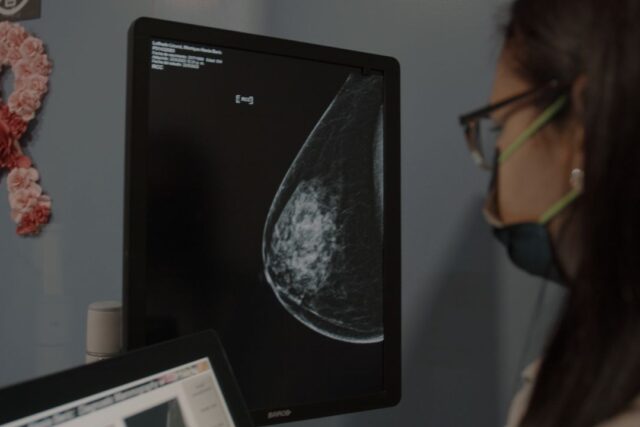 La mamografía y el ultrasonido: herramientas principales para el diagnóstico precoz en el Día Mundial contra el cáncer de ma