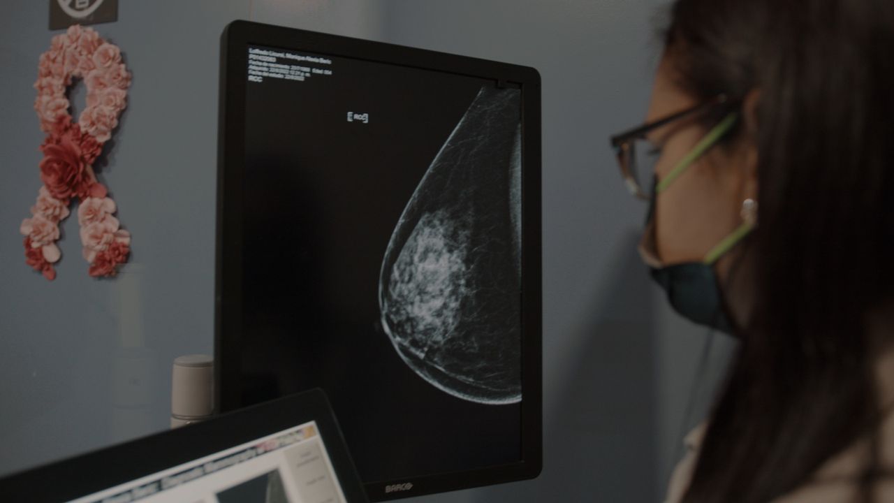 La mamografía y el ultrasonido: herramientas principales para el diagnóstico precoz en el Día Mundial contra el cáncer de ma